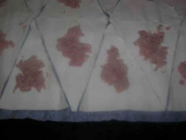 Cornetti di sfoglia al tonno - Preparazione tappa 2